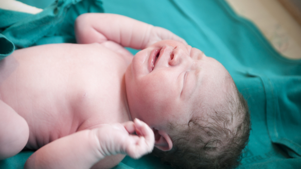 Sen avnavling kan förhindra blodbrist hos nyfödda